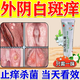外陰白斑專(zhuān)用藥止癢去根外陰白斑專(zhuān)用膏藥萎縮營(yíng)養不良修復膏婦科炎癥外陰瘙癢專(zhuān)用藥止癢殺菌消炎維a酸乳膏 1盒【中藥配方 殺菌不刺激】止癢消炎抗菌