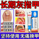 金歸灰指甲特新效期專(zhuān)用藥指甲真菌感染脫甲指甲增厚發(fā)黃變厚變空灰指甲用什么藥好的快皮膚用藥環(huán)吡酮胺乳膏  1盒【建議多盒持續用藥 國藥準字】正品保真