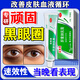 肝素鈉乳膏黑眼圈去黑眼圈重度女士專(zhuān)用熬夜眼部黑色素沉淀祛黑眼圈男士黑眼圈重度去除淡化細紋黑色素眼霜 【單盒】黑眼圈專(zhuān)用藥 特新效期【國藥準字】