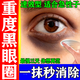 黑眼圈重度去除黑色素去黑眼圈專(zhuān)用眼部黑色素沉淀男士專(zhuān)用熬夜祛黑眼圈去除黑色素沉淀淡化細紋紅霉素眼膏 1盒【黑眼圈重度去除專(zhuān)用藥】國藥正品醫用