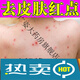 【藥房直售】夏天治療皮膚癢的身上起紅疙瘩長(cháng)小紅點(diǎn)前胸后背長(cháng)痘痘止癢膏 單盒裝