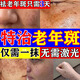 維a酸乳膏去老年斑專(zhuān)用藥一夜消祛斑專(zhuān)用藥去除老人斑的特專(zhuān)用效藥臉部手背強力去黑色素黃褐斑男女士專(zhuān)用藥 1盒【祛斑美白 淡化黑色素】去老年斑藥膏