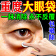 眼袋貼去眼袋消除重度嚴重中老年專(zhuān)用男女士去眼袋消除眼袋霜神器 1盒【消眼袋】體驗裝