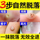 千紹方跖疣專(zhuān)用膏藥腳底趾疣去足底根專(zhuān)用hpv拓跖疣膏貼肉刺疣凈雞眼膏 1盒滴液