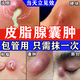 皮脂腺囊腫專用藥膏拔毒藥膏火癤子膿包疙瘩皮脂腺囊腫脂肪瘤專用特硬塊效藥皮膚用藥 非處方藥莫匹羅星軟膏 1盒【皮脂腺囊腫專用藥膏】早用早好