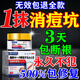 秋雅奈緒痘坑修復凹洞祛痘印修復淡化痘印痘坑修復男士去痘痘和痘印醫用膏 特效1盒裝【痤瘡男女士通用】 淡化消填充再生凝膠生長(cháng)因子
