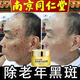 虎修堂去斑去黑色素男士祛斑霜祛黃褐斑老年斑雀斑黑色素沉淀臉部排毒 2瓶?jì)?yōu)惠裝