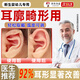 耳廓矯正器嬰兒新生兒招風(fēng)耳廓矯正器寶寶耳朵定型矯正器硅膠耳夾耳廓貼醫用級矯正器 【耳撐一對】適用于疊耳垂耳--送固定水凝膠貼