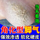 角化型腳氣頑固性真菌感染角質(zhì)增厚腳后跟干裂專(zhuān)用藥腳脫皮去真菌皮膚干裂脫皮厚硬手足鱗屑型硝酸咪康唑乳膏 1盒【足跟粗糙開(kāi)裂脫皮】主圖視覺(jué)特效