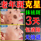巖井昃弘去老年斑的藥強力祛除手部臉部特效非藥專(zhuān)用點(diǎn)祛斑霜一夜消美白 特效1盒膏【祛斑霜】多買(mǎi)多送 日本進(jìn)口醫用淡化黑色素黃褐雀曬斑男女士美容院專(zhuān)用的