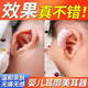 耳廓矯正器嬰兒新生兒招風(fēng)耳廓矯正器寶寶耳朵定型矯正器硅膠耳夾耳廓貼醫用級矯正器 【耳托一對】適用于貼耳面--送固定水凝膠貼