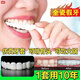 牙套通用吃飯成人永久假牙真假牙吃飯美白缺牙蛀牙男女通用 【上】+杜仲膠+盒子【龍煒口腔】牙套-2025新款