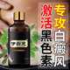 伊白克白癜癜風(fēng)外用促黑色素生長快速消白斑伊白克補(bǔ)骨脂酊見效藥膏 小瓶體驗(yàn)