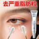 【去脂肪粒眼部眼霜】精華眼霜汗管粒油脂粒去除神器眼角正品 涂完就掉