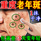 櫻資曼祛斑霜老年斑專(zhuān)用(非藥)一夜消男女士強力祛除手部臉部去老人斑膏 一盒裝(白凈如初) (發(fā)貨特效快)專(zhuān)用美白淡化黑色素去雀斑黃褐斑醫用正品