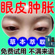 腫眼泡去脂消腫眼部脂肪厚上眼皮松弛眼睛水腫紅腫提拉緊致眼精油 單盒體驗裝