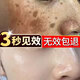 泊泉雅老年斑專(zhuān)用的藥一夜消特效祛斑霜強力去除手背部臉部黑色素專(zhuān)用 特效【1盒裝】快速祛斑