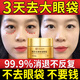 北京同仁堂抗皺眼霜淡化細紋提拉緊致黑眼圈去眼袋脂肪粒男女士眼周保濕熬夜 第2瓶半價(jià)【輕度眼袋  黑眼圈】