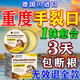 香港大藥房防裂膏手足干裂手裂愈合膏手足皮膚干燥皸裂膏手指裂口護手霜皴裂 1盒【德國進(jìn)口】手腳開(kāi)裂干裂修復膏藥專(zhuān)用治防凍的 冬天嚴重女男士改善脫皮日本進(jìn)口粗糙凡士林干裂貼馬油