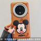 適用華為mate70pro+手機殼情侶卡通可愛(ài)立體米奇iphone16pro皮套 大孔氣墊棕底米奇+立體米奇單殼 華為Pura70