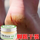 南同博士腳后跟干裂起硬皮足跟防開(kāi)裂口修復霜手足皸裂干燥脫皮手腳防裂膏 1盒裝【體驗裝】