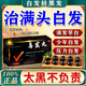 [順勢]烏發(fā)丸 9g*10丸 5盒裝 白頭發(fā)變黑治藥根官方正品純中藥脫發(fā)白發(fā)藥品治早白發(fā)專(zhuān)用藥轉黑發(fā)吃什么藥【視覺(jué)特效】 滿(mǎn)頭白發(fā)療程裝