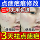 伊藤薬制去痣點(diǎn)痣膏醫用美容院專(zhuān)用官方正品同款祛痣膏去黑痣臉部不留疤水 京自倉100%特效發(fā)貨【點(diǎn)痣套裝】 痣套裝去痣液用去黑痣肉痣痦子瘊子