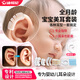 迪福倫嬰兒硅膠耳廓美耳夾器新生兒耳朵矯正貼寶寶招風(fēng)耳垂耳隱耳畸形 全月齡無(wú)憂(yōu)雙耳套裝