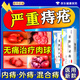 重度庤瘡藥膏痔瘡膏去肉球內外混合痔瘡專(zhuān)用藥止痛大便出血斷藥根肛門(mén)瘙癢止癢醫用凝膠[主圖特效]熊膽痔靈膏 2盒【內痔便血 肛裂瘙癢】 可搭配北京同仁堂痔瘡凝膠