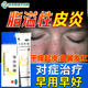 [三順]參皇軟膏 30g 1盒裝 脂溢性皮炎面部專(zhuān)用藥鼻子兩側發(fā)紅脫皮臉部過(guò)敏紅腫干癢泛紅起皮膚干燥手脫皮專(zhuān)用藥膏 皮膚干燥 臉上干燥起皮