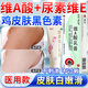 維a酸乳膏和尿素維e軟膏去黑色素沉淀雞皮膚疙瘩毛囊角化癥專(zhuān)用藥脖子頸紋關(guān)節屁股腋下黑[視覺(jué)特效]皮膚用藥 3盒+3盒搭配【專(zhuān)攻雞皮膚黑色素】