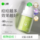 U牌祛痘精華小綠瓶祛痘敏感肌保濕抗皺緊致舒緩控油溫和旗艦店 植物祛痘精華30ml