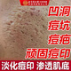同仁堂祛痘印修復淡化痘印痘坑修復凹洞去痘坑去痘疤去痘痘和痘印粉刺 三盒周期裝【多數客戶(hù)選擇】
