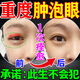腫眼泡消脂消腫眼部脂肪厚上眼皮浮腫松弛眼睛水腫去除專(zhuān)用膏藥貼 一盒 祛除腫泡眼消腫液