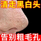 去黑頭清理神器深層清潔撕拉吸鼻貼面膜泥痘痘毛孔粉刺男女士收縮 去黑頭鼻膜