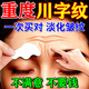 絲幕川字紋眉間貼去皺紋去法令紋去抬頭紋去川字紋去除神器男士重度 1盒【川字紋眉間貼】 抬頭紋去除男重度川字紋去除神器去皺紋去法令紋抬頭紋