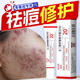 BAJK壬二酸凝膠去痘痘和祛痘印修復淡化痘印醫用祛痘痘藥膏青少年專(zhuān)用 【祛痘淡印】壬二酸凝膠20%醫用祛痘藥膏1支 壬二酸凝膠祛痘凝露淡化痘印痘坑修復淡化黑色素沉淀