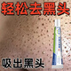 去黑頭鼻膜收縮毛孔粉刺深層清潔草莓鼻袪吸神器男女專(zhuān)用撕拉面膜 去黑頭鼻膜