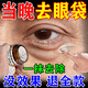 眼袋霜去大眼袋嚴重中老年專(zhuān)用消除男女士重度眼袋祛去除神器進(jìn)口 特效：買(mǎi)2送1【一抹見(jiàn)效】發(fā)三盒 眼袋下垂松弛浮腫皺紋貼夜間修復