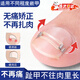 甲溝炎矯正神器指甲糾正器腳趾甲往肉里長(cháng)矯正器嵌甲貼片正甲扣 套裝款-（1只整裝）送墊子