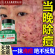 香港大藥房祛痘膏和痘印坑修復痘痘和痘印青春痘消炎痤瘡粉刺專(zhuān)用學(xué)生青少年 1瓶【買(mǎi)2送1】