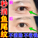 魚(yú)尾紋眼角紋去除神器男士女士抗皺提拉淡化眼部細紋快速舒展眼霜 三盒【99%人群首選】療程裝