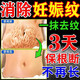 秋雅奈緒妊娠紋修復霜產(chǎn)后去疤痕消除緊致肚皮松弛專(zhuān)用淡化祛生長(cháng)肥胖紋膏 買(mǎi)2贈1【療程裝】 妊辰紋膏 日本祛疤痕油孕婦原裝進(jìn)口