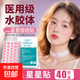 星星痘痘貼醫用卡通水膠體敷料非祛痘痕創(chuàng  )口貼人工皮豆豆貼 粉色款·星星款【40貼/袋】