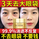 北京同仁堂抗皺眼霜淡化細紋提拉緊致黑眼圈去眼袋脂肪粒男女士眼周保濕熬夜 第2瓶半價(jià)【輕度眼袋  黑眼圈】