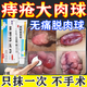 [黑寶]熊膽痔靈膏 痔瘡膏去肉球內外混合痔瘡專用藥痔瘡藥去肉球斷球根痔根止癢源消腫斷肛門瘙癢醫用凝膠 10g 3盒裝 【重度痔瘡肉球便血】