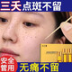 點(diǎn)斑藥水祛斑雀斑點(diǎn)斑專(zhuān)用美容院金水點(diǎn)祛斑遺傳雀斑否點(diǎn)痣膏水斑藥水無(wú)痕水 所有膚質(zhì) 1盒裝