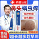 松井藤岡酒糟鼻專用治療修復(fù)紅鼻子血絲玫瑰痤瘡鼻子去螨蟲臉上除螨凝膠ZW 【買2送1】鼻子紅血絲有螨蟲毛孔粗大