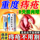 [黑寶]熊膽痔靈膏 痔瘡膏去肉球內外混合痔瘡專用藥去肉球消腫醫用痔瘡栓肛門瘙癢斷凝膠藥根【視覺特效】 10g 2盒裝 【醫用級痔瘡育 無痛消痔】