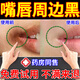 嘴角唇周去黑非淡化紋黑色素發(fā)黑去除改善唇周角黑嘴唇暗沉淡化唇色專(zhuān)用膏 輕度唇黑（單盒）